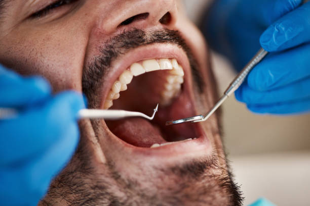 Best Emergency Broken Tooth Repair in Atwood, TN